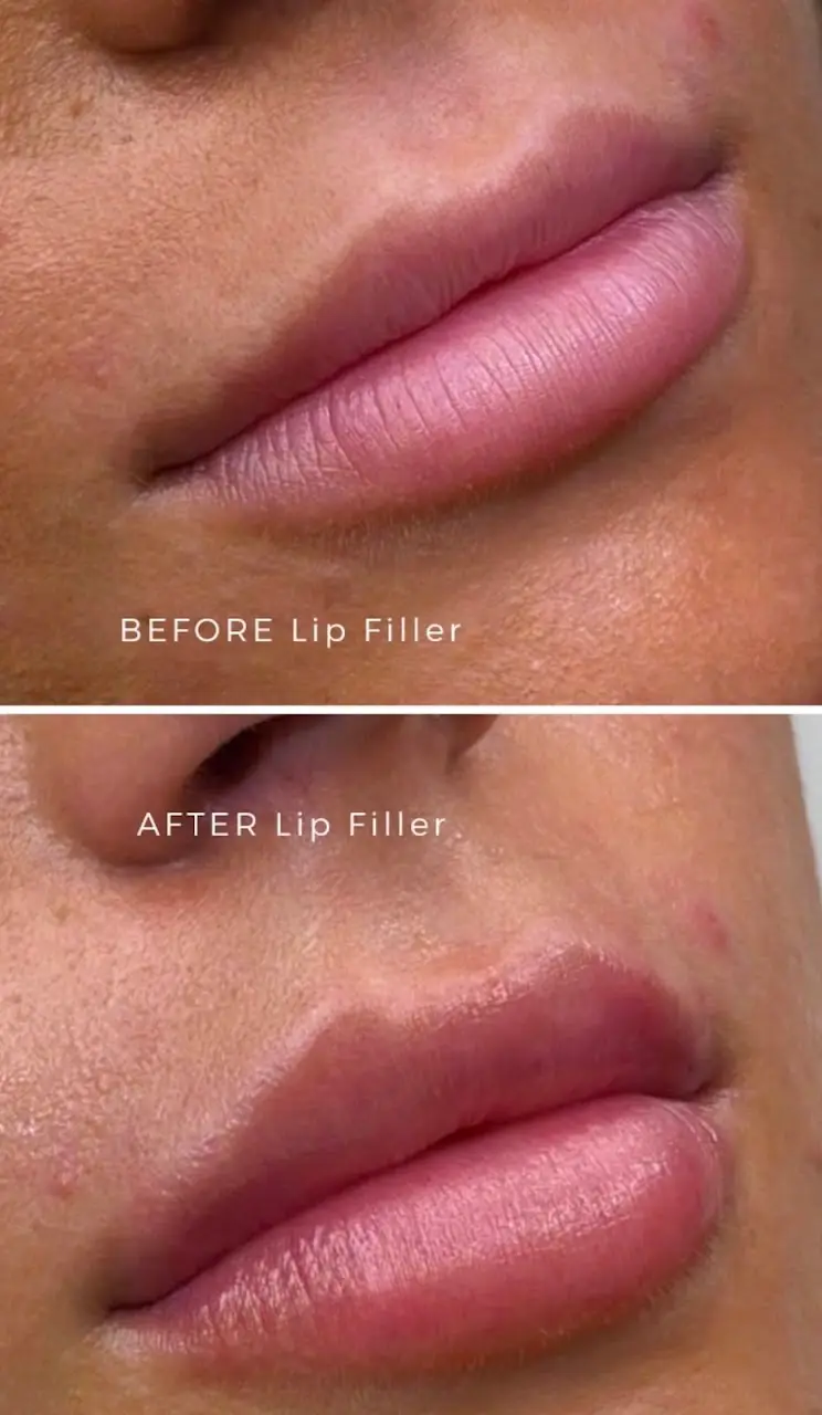 Photo from Isabella S.'s review of Versailles Medical Spa