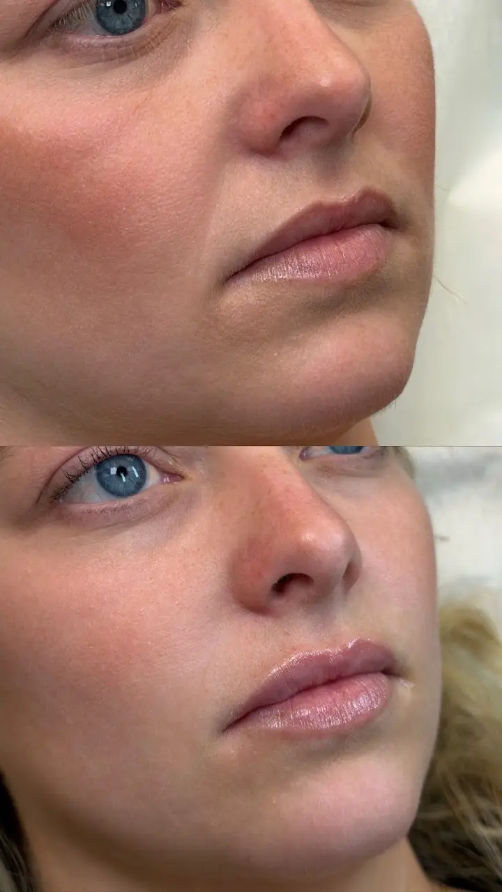 Photo from Emilie W.'s review of Versailles Medical Spa